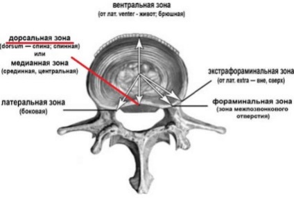 Herniated disc intervertebral formă și tratament gimnastică