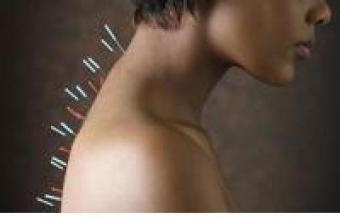 Acupunctura ajuta la renuntarea la fumat