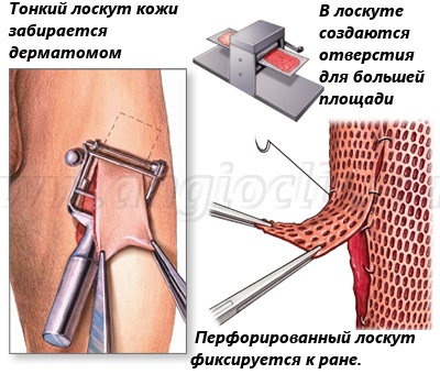 Innovatív Érrendszeri Központ (trofikus fekélyek, sebek) Innovatív Érrendszeri Központ