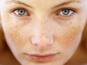 Як відбілити шкіру обличчя як в салоні домашніми засобами