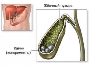 Як пити лляне масло для очищення організму