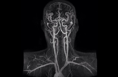 Cum se verifică vasele cerebrale și diagnosticarea gâtului la adulți și copii