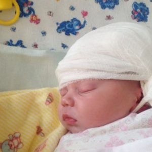 Kefalogematoma în rezultate neonatale, tratament, puncție și eliminare