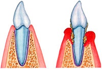 Лікування зубів без болю вао, гарантія якості, досвідчені лікарі, низька ціна лікування зубів в клініці