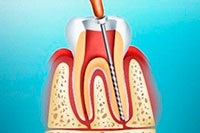 Tratamentul dinților fără durere vao, asigurarea calității, medici cu experiență, preț scăzut al tratamentului dentar în clinică