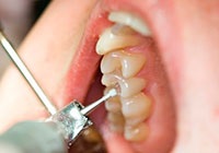 Tratamentul dinților fără durere vao, asigurarea calității, medici cu experiență, preț scăzut al tratamentului dentar în clinică