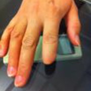 Москвичці вирощують відрізаний 10 років тому палець - чудеса науки - новини