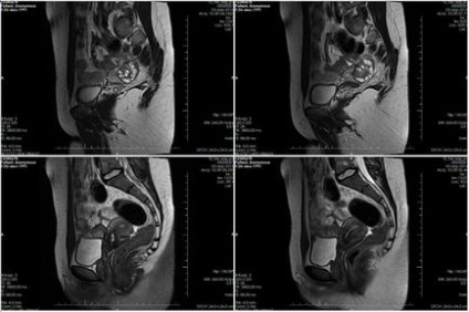 Organele de mirt ale micului pelvis din Moscova, unde poți să faci la cel mai bun preț, costul anesteziei pentru bărbați