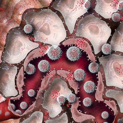 Nanoparticulele înfrângerea cancerului o nouă descoperire în oncologie, un jurnal de mecanică populară