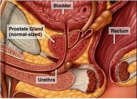 Caracteristicile tantalului medicamentos în prostatită