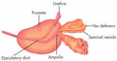 Caracteristicile tantalului medicamentos în prostatită