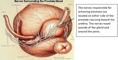 Caracteristicile tantalului medicamentos în prostatită