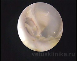 Otoscopia - metoda diagnosticului endoscopic