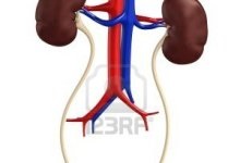 Ureteral curba, simptome, cauze