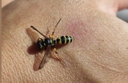 Primul ajutor cu o muscatura de o viespe
