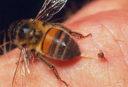 Primul ajutor cu o muscatura de o albina, o viespe, o bumblebee, un coarda, o medicina populara