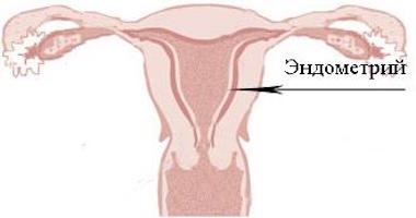 Cauze și metode de tratament a endometrului subțire