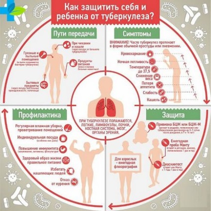Причини туберкульозу легенів