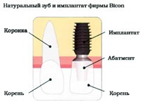 Prostomatology - paste Bicon és rágni szalonna!