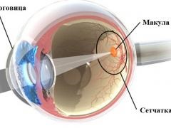 Розрив макули, симптоми, як діагностується, принципи лікування