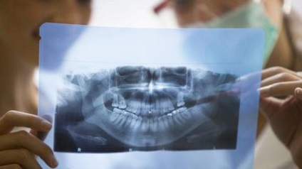 Рентген щелепи свідчення, де зробити, опис процедури