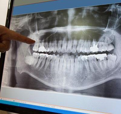 X-ray al indicației maxilarului, unde trebuie făcut, descrierea procedurii