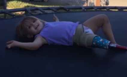 Părinții au cerut ca fiica să-și amputeze piciorul