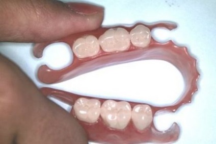 Знімні зубні протези - які краще вибрати і чому