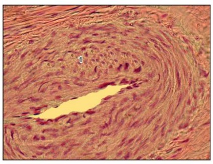 Sistemul cardiovascular