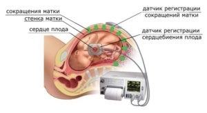 Серцебиття плоду - норма по тижнях, як визначити хлопчик або дівчинка