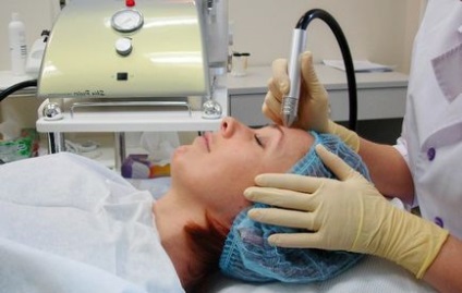Шліфування шкіри лазером і дермабразія відмінності - нова косметологія