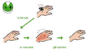 Bumblebee mușcături și alergii la ele - koppert control biologic polenizare naturale