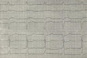 Sindromul Frederic, practica medicală - medicina modernă a bolilor, diagnosticarea acestora,