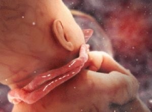 Visul unui embrion al unui copil în brațe pentru a-și păstra în somn să vadă ce visează