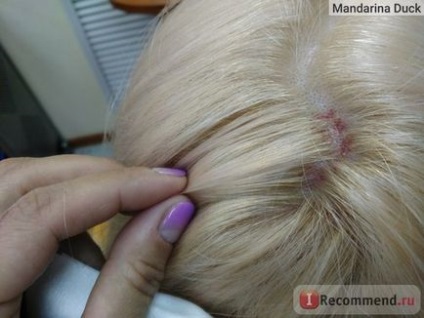 Засіб для волосся estel аква-гель для зняття роздратування шкіри no stress - «порятунок для блондинок