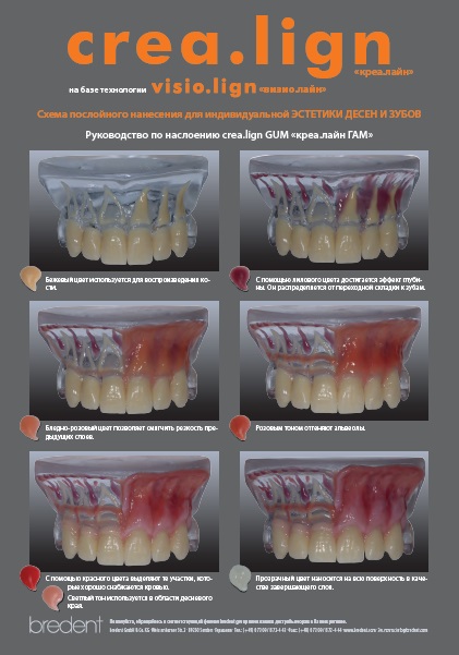 Magazin stomatologic bredent