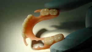 Термопластичні протези - іжевська стоматологія 32 перлини