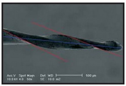 Tehnica pentru prelucrarea canalelor radiculare folosind sistemul de instrumente rotative de nichel-titan mtwo