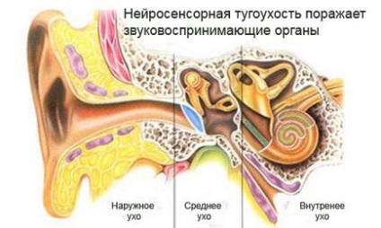 Туговухість 2 ступеня лікування, ступеня, відгуки