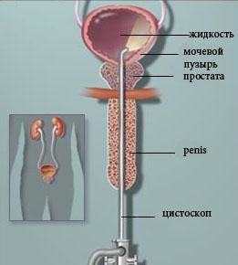 Urologie la Moscova, servicii ale centrului medical din Kolomna (