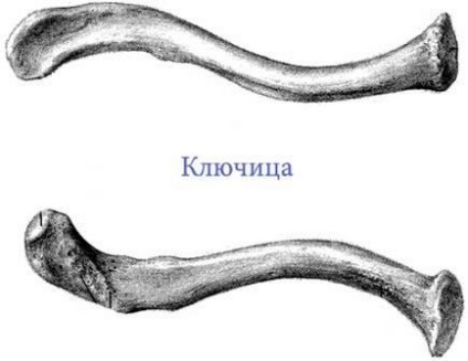 Вивих ключиці лікування, симптоми і перша допомога