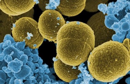 Refacerea imunității după antibiotice