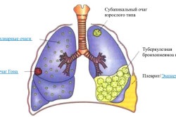 Збудник туберкульозу опис і властивості, мікобактерія туберкульозу, лікування