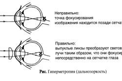 Вікові зміни зору