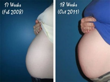 Totul despre 18 săptămâni de sarcină burtă, făt, fotografie