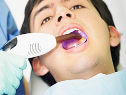 Хронічні інфекції порожнини рота карієс бактеріальна інфекція порожнини рота вірусні захворювання