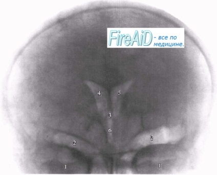 Anatomia examinării cu raze X a sistemului nervos central