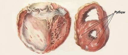 Bradycardia sportolók vajon lehetséges-e, hogy sportolni és Bert, hogy a hadsereg