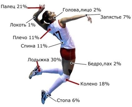Що означають наклейки у волейболісток на плечі (сині, чорні, червоні)