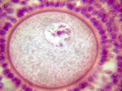 Câte spermatozoizi trăiesc în aer în corpul uterin, durata vieții în cifre